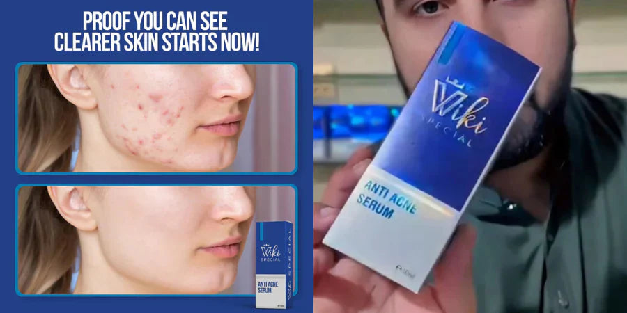 Wikki Special Serum – Glow Beyond Ordinary ✨